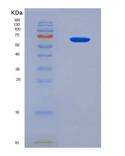 SDS-PAGE analysis of Human ALB (Albumin) - Recombinant Protein, CAT# BLT-08623P showing >90% purity under 15% SDS-PAGE (Reduced)Human ALB (Albumin) - Recombinant Protein
