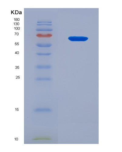 SDS-PAGE analysis of Human ALB (Albumin) - Recombinant Protein, CATHuman ALB (Albumin) - Recombinant Protein