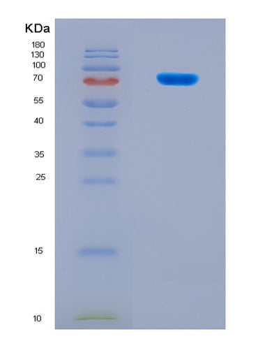 SDS-PAGE analysis of Human CUL2 (Cullin-2) - Recombinant Protein, CAT# BLT-08624P showing >90% purity under 15% SDS-PAGE (Reduced)Human CUL2 (Cullin-2) - Recombinant Protein