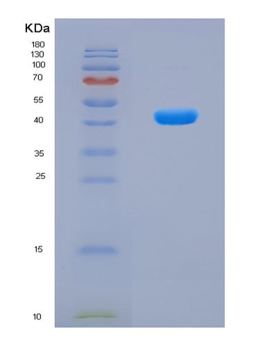 SDS-PAGE analysis of Human ALDOA (Fructose-Bisphosphate Aldolase A) - Recombinant Protein, CAT# BLT-08625P showing >90% purity under 15% SDS-PAGE (Reduced)Human ALDOA (Fructose-Bisphosphate Aldolase A) - Recombinant Protein