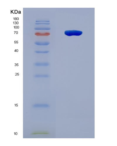 SDS-PAGE analysis of Human SPP1 (Osteopontin) - Recombinant Protein, CAT# BLT-08628P showing >90% purity under 15% SDS-PAGE (Reduced)Human SPP1 (Osteopontin) - Recombinant Protein