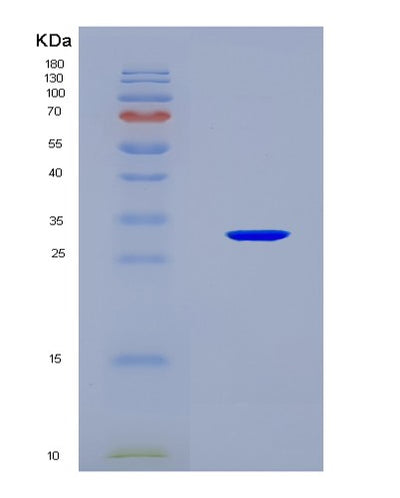 SDS-PAGE analysis of Mouse Insrr (Insulin Receptor-Related Protein) - Recombinant Protein, CAT# BLT-08629P showing >90% purity under 15% SDS-PAGE (Reduced)Mouse Insrr (Insulin Receptor-Related Protein) - Recombinant Protein