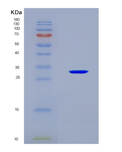 SDS-PAGE analysis of Mouse Insrr (Insulin Receptor-Related Protein) - Recombinant Protein, CATMouse Insrr (Insulin Receptor-Related Protein) - Recombinant Protein