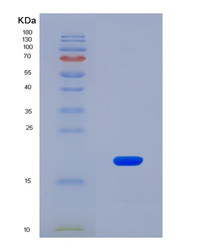 SDS-PAGE analysis of Human COL6A1 (Collagen Alpha-1(Vi) Chain) - Recombinant Protein, CAT# BLT-08632P showing >90% purity under 15% SDS-PAGE (Reduced)Human COL6A1 (Collagen Alpha-1(Vi) Chain) - Recombinant Protein