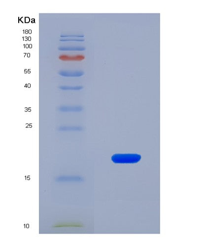 SDS-PAGE analysis of Human COL6A1 (Collagen Alpha-1(Vi) Chain) - Recombinant Protein, CATHuman COL6A1 (Collagen Alpha-1(Vi) Chain) - Recombinant Protein