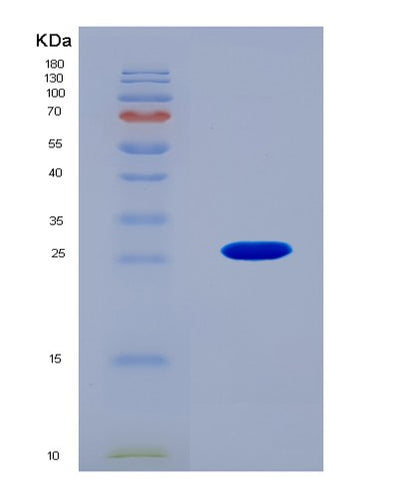 SDS-PAGE analysis of Human COL5A1 (Collagen Alpha-1(V) Chain) - Recombinant Protein, CAT# BLT-08633P showing >90% purity under 15% SDS-PAGE (Reduced)Human COL5A1 (Collagen Alpha-1(V) Chain) - Recombinant Protein