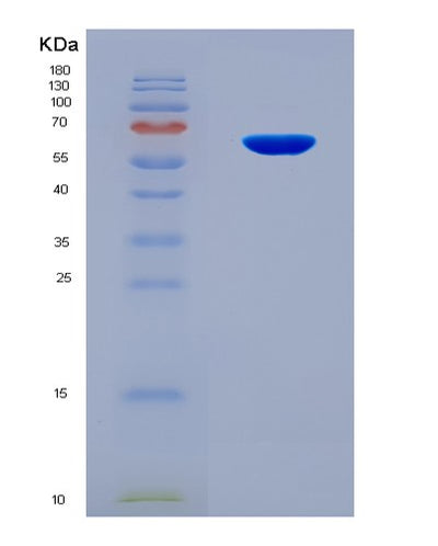 SDS-PAGE analysis of Mouse Ism1 (Isthmin-1) - Recombinant Protein, CAT# BLT-08634P showing >90% purity under 15% SDS-PAGE (Reduced)Mouse Ism1 (Isthmin-1) - Recombinant Protein