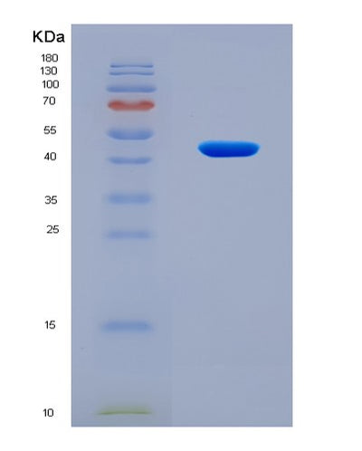 SDS-PAGE analysis of Human ZBP1 (Z-Dna-Binding Protein 1) - Recombinant Protein, CAT# BLT-08635P showing >90% purity under 15% SDS-PAGE (Reduced)Human ZBP1 (Z-Dna-Binding Protein 1) - Recombinant Protein