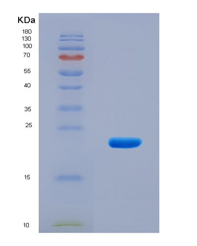 SDS-PAGE analysis of Human ACKR3 (Atypical Chemokine Receptor 3) - Recombinant Protein, CATHuman ACKR3 (Atypical Chemokine Receptor 3) - Recombinant Protein
