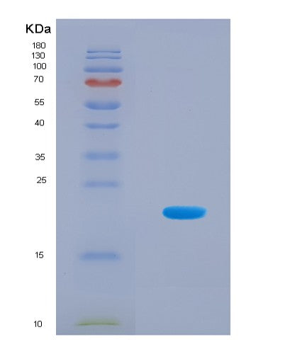 SDS-PAGE analysis of Human CXCR4 (C-X-C Chemokine Receptor Type 4) - Recombinant Protein, CATHuman CXCR4 (C-X-C Chemokine Receptor Type 4) - Recombinant Protein