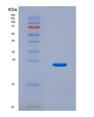 SDS-PAGE analysis of Human RNF43 (E3 Ubiquitin-Protein Ligase Rnf43) - Recombinant Protein, CAT# BLT-08638P showing >90% purity under 15% SDS-PAGE (Reduced)Human RNF43 (E3 Ubiquitin-Protein Ligase Rnf43) - Recombinant Protein