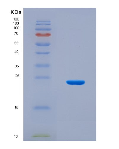 SDS-PAGE analysis of Human RNF43 (E3 Ubiquitin-Protein Ligase Rnf43) - Recombinant Protein, CATHuman RNF43 (E3 Ubiquitin-Protein Ligase Rnf43) - Recombinant Protein