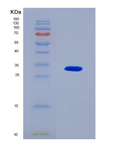SDS-PAGE analysis of Human ZNRF3 (E3 Ubiquitin-Protein Ligase Znrf3) - Recombinant Protein, CAT# BLT-08639P showing >90% purity under 15% SDS-PAGE (Reduced)Human ZNRF3 (E3 Ubiquitin-Protein Ligase Znrf3) - Recombinant Protein