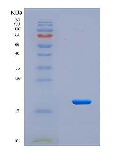 SDS-PAGE analysis of Human PLAU (Urokinase-Type Plasminogen Activator) - Recombinant Protein, CAT# BLT-08641P showing >90% purity under 15% SDS-PAGE (Reduced)Human PLAU (Urokinase-Type Plasminogen Activator) - Recombinant Protein