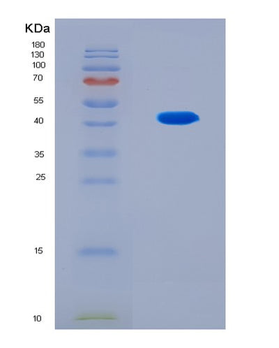 SDS-PAGE analysis of Human WFDC2 (Wap Four-Disulfide Core Domain Protein 2) - Recombinant Protein, CAT# BLT-08645P showing >90% purity under 15% SDS-PAGE (Reduced)Human WFDC2 (Wap Four-Disulfide Core Domain Protein 2) - Recombinant Protein