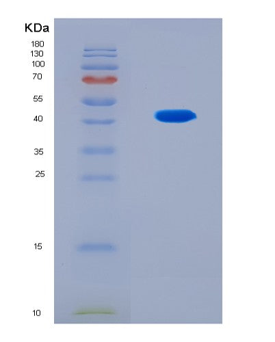 SDS-PAGE analysis of Human WFDC2 (Wap Four-Disulfide Core Domain Protein 2) - Recombinant Protein, CATHuman WFDC2 (Wap Four-Disulfide Core Domain Protein 2) - Recombinant Protein