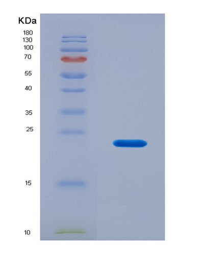 SDS-PAGE analysis of Human ITGB8 (Integrin Beta-8) - Recombinant Protein, CAT# BLT-08647P showing >90% purity under 15% SDS-PAGE (Reduced)Human ITGB8 (Integrin Beta-8) - Recombinant Protein
