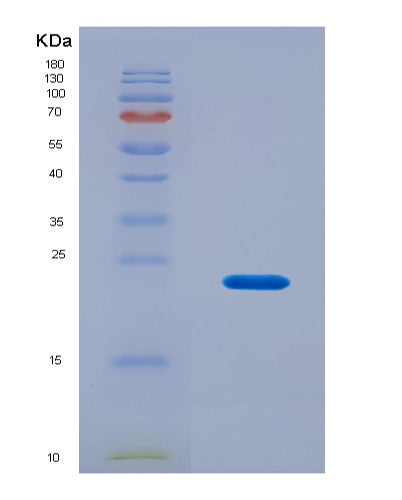 SDS-PAGE analysis of Human ITGB8 (Integrin Beta-8) - Recombinant Protein, CATHuman ITGB8 (Integrin Beta-8) - Recombinant Protein