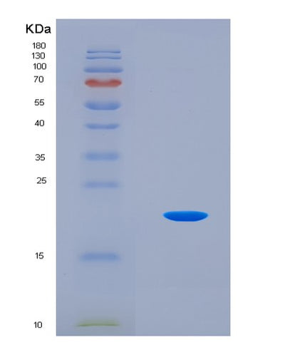 SDS-PAGE analysis of Mouse Fgf2 (Fibroblast Growth Factor 2) - Recombinant Protein, CAT# BLT-08651P showing >95% purity under 15% SDS-PAGE (Reduced)Mouse Fgf2 (Fibroblast Growth Factor 2) - Recombinant Protein