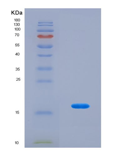 SDS-PAGE analysis of Human ATG12 (Ubiquitin-Like Protein Atg12) - Recombinant Protein, CAT# BLT-08652P showing >90% purity under 15% SDS-PAGE (Reduced)Human ATG12 (Ubiquitin-Like Protein Atg12) - Recombinant Protein