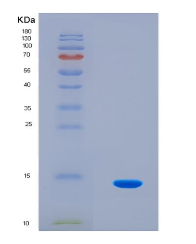 SDS-PAGE analysis of Human SNCA (Alpha-Synuclein) - Recombinant Protein, CAT# BLT-08654P showing >90% purity under 15% SDS-PAGE (Reduced)Human SNCA (Alpha-Synuclein) - Recombinant Protein