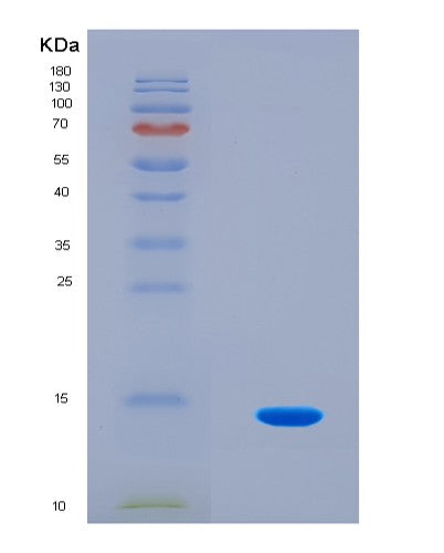 SDS-PAGE analysis of Human SNCA (Alpha-Synuclein) - Recombinant Protein, CATHuman SNCA (Alpha-Synuclein) - Recombinant Protein