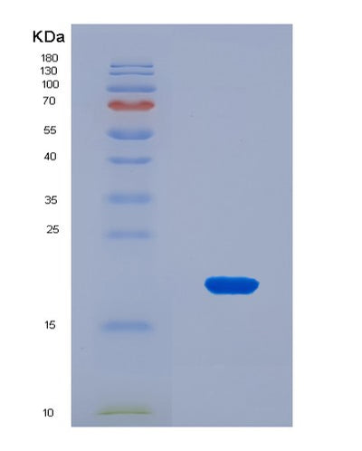 SDS-PAGE analysis of Human LRIG3 (Leucine-Rich Repeats And Immunoglobulin-Like Domains Protein 3) - Recombinant Protein, CAT# BLT-08655P showing >90% purity under 15% SDS-PAGE (Reduced)Human LRIG3 (Leucine-Rich Repeats And Immunoglobulin-Like Domains Protein 3) - Recombinant Protein