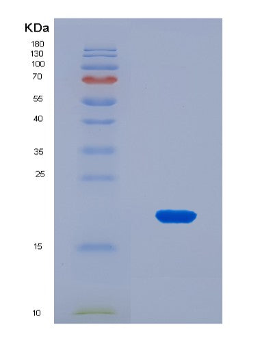 SDS-PAGE analysis of Human LRIG3 (Leucine-Rich Repeats And Immunoglobulin-Like Domains Protein 3) - Recombinant Protein, CATHuman LRIG3 (Leucine-Rich Repeats And Immunoglobulin-Like Domains Protein 3) - Recombinant Protein