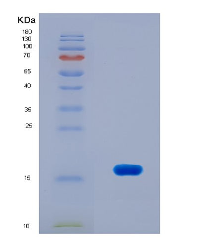 SDS-PAGE analysis of Mouse Nmu (Neuromedin-U) - Recombinant Protein, CAT# BLT-08658P showing >90% purity under 15% SDS-PAGE (Reduced)Mouse Nmu (Neuromedin-U) - Recombinant Protein