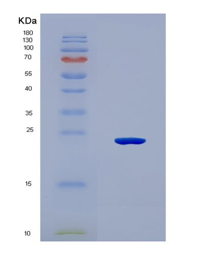 SDS-PAGE analysis of Human PER1 (Period Circadian Protein Homolog 1) - Recombinant Protein, CAT# BLT-08660P showing >90% purity under 15% SDS-PAGE (Reduced)Human PER1 (Period Circadian Protein Homolog 1) - Recombinant Protein
