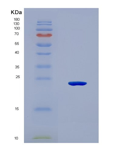 SDS-PAGE analysis of Human PER1 (Period Circadian Protein Homolog 1) - Recombinant Protein, CATHuman PER1 (Period Circadian Protein Homolog 1) - Recombinant Protein