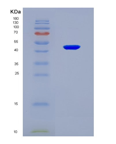 SDS-PAGE analysis of Human ALKBH5 (Rna Demethylase Alkbh5) - Recombinant Protein, CATHuman ALKBH5 (Rna Demethylase Alkbh5) - Recombinant Protein