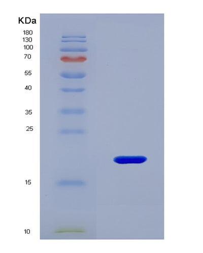 SDS-PAGE analysis of Mouse Rrn3 (Rna Polymerase I-Specific Transcription Initiation Factor Rrn3) - Recombinant Protein, CAT# BLT-08663P showing >90% purity under 15% SDS-PAGE (Reduced)Mouse Rrn3 (Rna Polymerase I-Specific Transcription Initiation Factor Rrn3) - Recombinant Protein