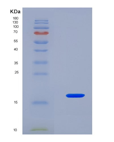 SDS-PAGE analysis of Mouse Rprd2 (Regulation Of Nuclear Pre-Mrna Domain-Containing Protein 2) - Recombinant Protein, CATMouse Rprd2 (Regulation Of Nuclear Pre-Mrna Domain-Containing Protein 2) - Recombinant Protein