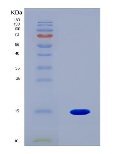 SDS-PAGE analysis of Mouse Saa3 (Serum Amyloid A-3 Protein) - Recombinant Protein, CAT# BLT-08665P showing >90% purity under 15% SDS-PAGE (Reduced)Mouse Saa3 (Serum Amyloid A-3 Protein) - Recombinant Protein