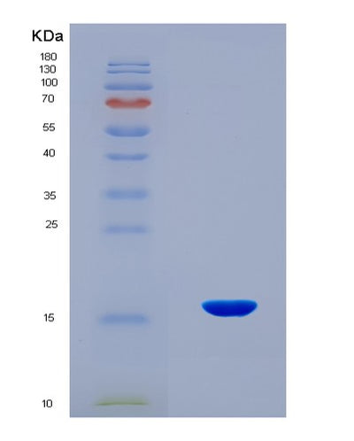 SDS-PAGE analysis of Mouse H2ac4 (Histone H2A Type 1-B) - Recombinant Protein, CAT# BLT-08666P showing >90% purity under 15% SDS-PAGE (Reduced)Mouse H2ac4 (Histone H2A Type 1-B) - Recombinant Protein