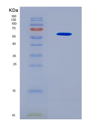 SDS-PAGE analysis of Human GBP5 (Guanylate-Binding Protein 5) - Recombinant Protein, CAT# BLT-08671P showing >90% purity under 15% SDS-PAGE (Reduced)Human GBP5 (Guanylate-Binding Protein 5) - Recombinant Protein