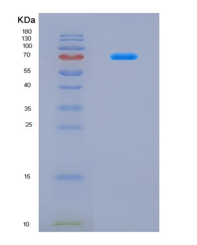 SDS-PAGE analysis of Human COP1 (E3 Ubiquitin-Protein Ligase Cop1) - Recombinant Protein, CAT# BLT-08677P showing >90% purity under 15% SDS-PAGE (Reduced)Human COP1 (E3 Ubiquitin-Protein Ligase Cop1) - Recombinant Protein