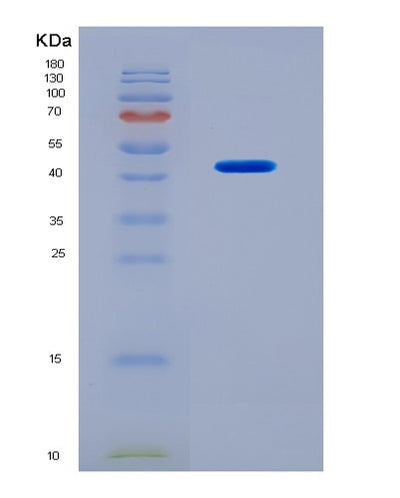 SDS-PAGE analysis of Human BMP10 (Bone Morphogenetic Protein 10) - Recombinant Protein, CAT# BLT-08679P showing >90% purity under 15% SDS-PAGE (Reduced)Human BMP10 (Bone Morphogenetic Protein 10) - Recombinant Protein