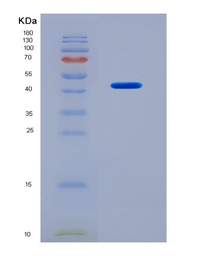 SDS-PAGE analysis of Human BMP10 (Bone Morphogenetic Protein 10) - Recombinant Protein, CATHuman BMP10 (Bone Morphogenetic Protein 10) - Recombinant Protein