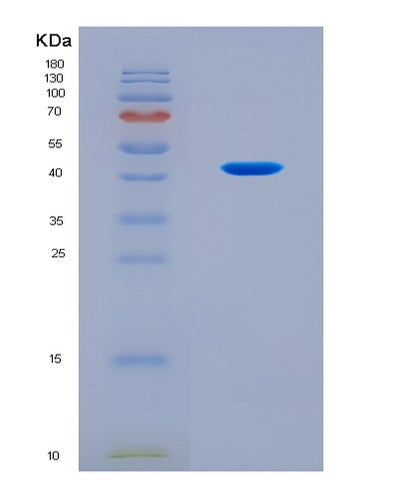 SDS-PAGE analysis of Human FUT3 (3-Galactosyl-N-Acetylglucosaminide 4-Alpha-L-Fucosyltransferase Fut3) - Recombinant Protein, CAT# BLT-08680P showing >90% purity under 15% SDS-PAGE (Reduced)Human FUT3 (3-Galactosyl-N-Acetylglucosaminide 4-Alpha-L-Fucosyltransferase Fut3) - Recombinant Protein