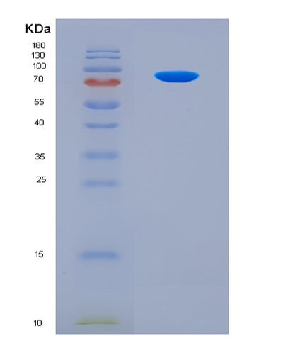 SDS-PAGE analysis of Human CRY1 (Cryptochrome-1) - Recombinant Protein, CAT# BLT-08683P showing >90% purity under 15% SDS-PAGE (Reduced)Human CRY1 (Cryptochrome-1) - Recombinant Protein