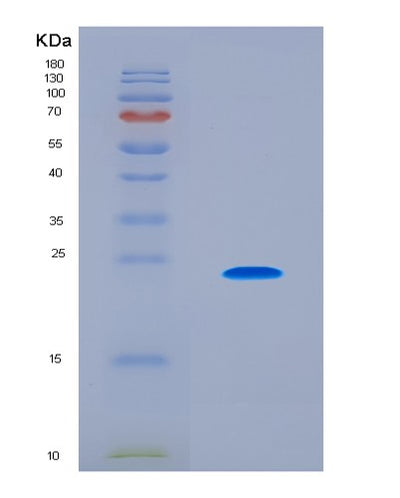 SDS-PAGE analysis of Human CLEC4C (C-Type Lectin Domain Family 4 Member C) - Recombinant Protein, CAT# BLT-08685P showing >90% purity under 15% SDS-PAGE (Reduced)Human CLEC4C (C-Type Lectin Domain Family 4 Member C) - Recombinant Protein