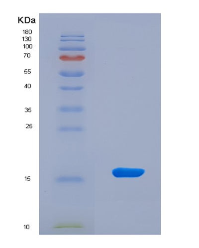 SDS-PAGE analysis of Mouse Vegfc (Vascular Endothelial Growth Factor C) - Recombinant Protein, CAT# BLT-08686P showing >90% purity under 15% SDS-PAGE (Reduced)Mouse Vegfc (Vascular Endothelial Growth Factor C) - Recombinant Protein