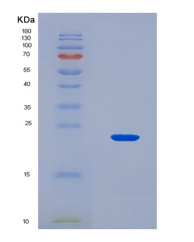 SDS-PAGE analysis of Mouse Bax (Apoptosis Regulator Bax) - Recombinant Protein, CAT# BLT-08687P showing >90% purity under 15% SDS-PAGE (Reduced)Mouse Bax (Apoptosis Regulator Bax) - Recombinant Protein
