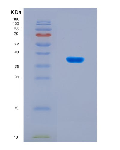 SDS-PAGE analysis of Human AGER (Advanced Glycosylation End Product-Specific Receptor) - Recombinant Protein, CAT# BLT-08688P showing >90% purity under 15% SDS-PAGE (Reduced)Human AGER (Advanced Glycosylation End Product-Specific Receptor) - Recombinant Protein