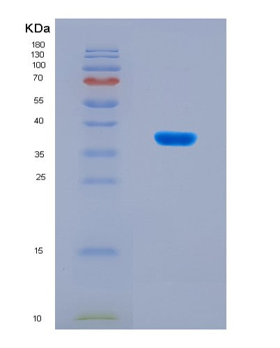 SDS-PAGE analysis of Human AGER (Advanced Glycosylation End Product-Specific Receptor) - Recombinant Protein, CATHuman AGER (Advanced Glycosylation End Product-Specific Receptor) - Recombinant Protein