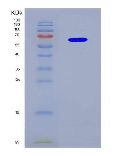 SDS-PAGE analysis of Human CYP19A1 (Aromatase) - Recombinant Protein, CAT# BLT-08691P showing >90% purity under 15% SDS-PAGE (Reduced)Human CYP19A1 (Aromatase) - Recombinant Protein