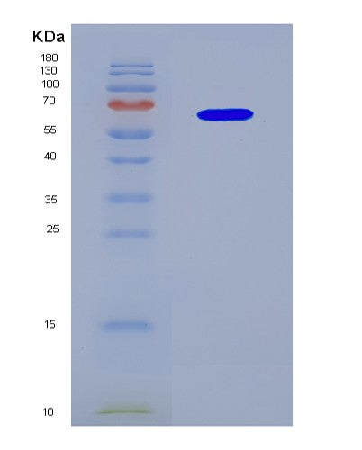SDS-PAGE analysis of Human CYP19A1 (Aromatase) - Recombinant Protein, CATHuman CYP19A1 (Aromatase) - Recombinant Protein