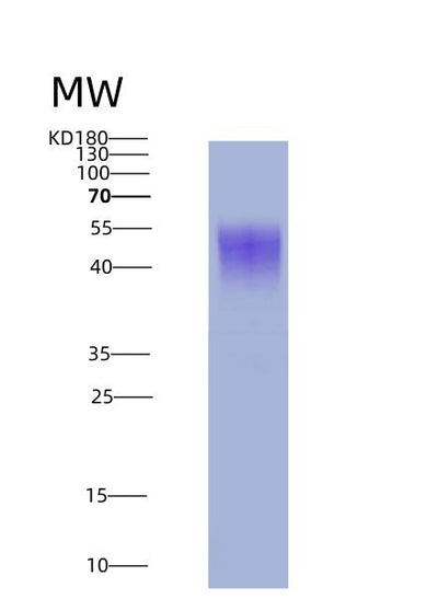 SDS-PAGE analysis of Mouse Il2ra (Interleukin-2 Receptor Subunit Alpha) - Recombinant Protein, CAT# BLT-08693P showing >90% purity under 15% SDS-PAGE (Reduced)Mouse Il2ra (Interleukin-2 Receptor Subunit Alpha) - Recombinant Protein